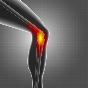 Knee-arthritis-treatment